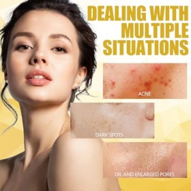 55 Tampons Dacide Kojique au Curcuma, Tampons Nettoyants au Curcuma, Tampons Nettoyants au Curcuma, Tampons Exfoliants pour 