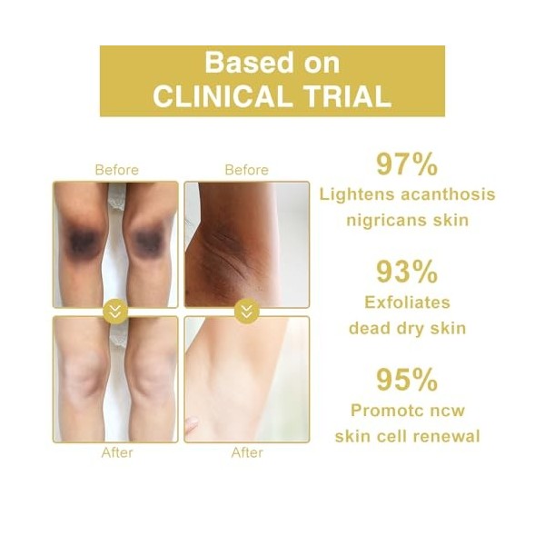 Fengyang® Huile Exfoliante, Nourrissant Hydratant Exfoliant Huiles, Huile De Peeling Jaune, Huile Peeling Pour Le Corps, pour