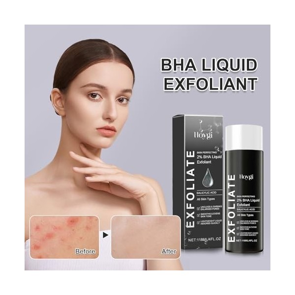 2 Flacons Peeling Chimique pour Visage, Crème Peeling Douce, Peeling Enzymatique pour Visage, Exfoliant pour Visage our Femme