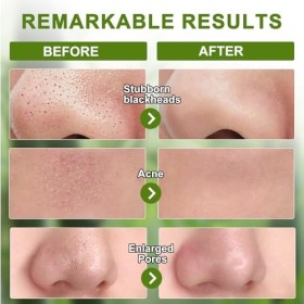 48 Pcs Patch Point Noir, Patchs Anti-Points Noirs, Patch Nez Point Noir, Charbon de Bambou Nettoyage en Profondeur Patch Poin