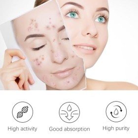 Lot de 20 patchs anti-acné hydrocolloïdes pour le visage, le menton, le dos et le corps avec extrait de centella et acide hya