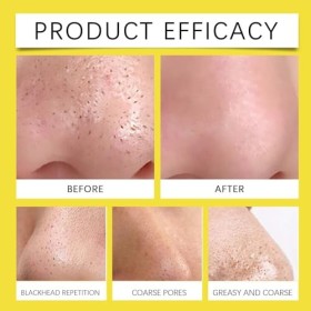 Lot de 24 bandes anti-comédons pour comédons noirs, retrait doux des points noirs et nettoyage en profondeur, patchs nasaux h