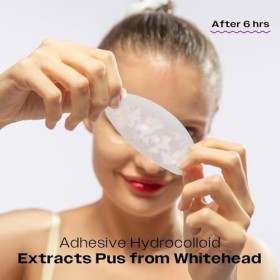 AVARELLE Bandes et patchs anti-comédons pour pores | Bandes nasales hydrocolloïdes Dissolvant de points noirs| avec arbre à t