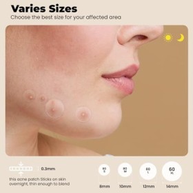 ROSELYNBOUTIQUE Lot de 300 patchs anti-acné hydrocolloïdes pour le visage avec huile darbre à thé, acide salicylique, CICA d