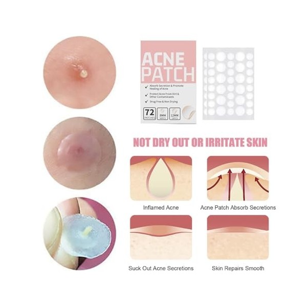 Lot de 216 patchs hydrocolloïdes ronds transparents – Patch hydratant contre lacné – Cachent et protègent les zones dacné –