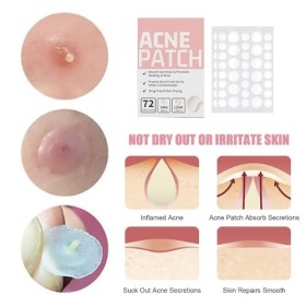 Lot de 216 patchs hydrocolloïdes ronds transparents – Patch hydratant contre lacné – Cachent et protègent les zones dacné –