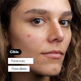 Skin & Out - PEEL OUT, Patchs nez purifiants x5 - Traitement des points noirs - Absorption efficace des impuretés - Réduit l