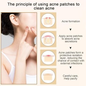 300PCS Patch Boutons Acne, Patch Bouton Pimple Patches,Patch Anti Bouton Invisible, Hydrocolloide Acné Patch Invisible Nature