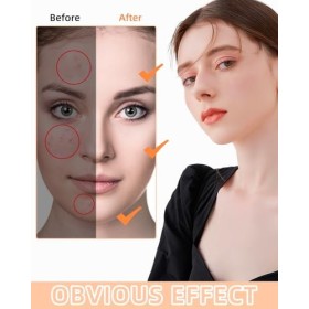 430PCS Patch Boutons Acne,Patch Acne Pimple Anti Acné Étoile Imperméable Autocollants Hydrocolloïde,Traitement Naturel Anti-B