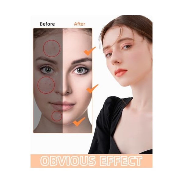 430PCS Patch Boutons Acne,Patch Acne Pimple Anti Acné Étoile Imperméable Autocollants Hydrocolloïde,Traitement Naturel Anti-B