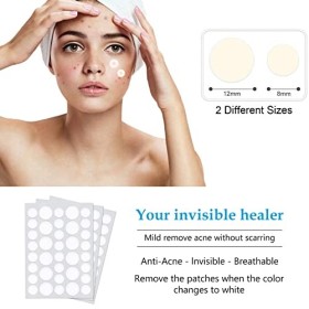 Patch Anti-Acné, Acné Pimple Patch, Patch Anti-Acné Absorbant Bouton, 216 Pièces Patch Couverture Absorbante Pour Bouton Dac