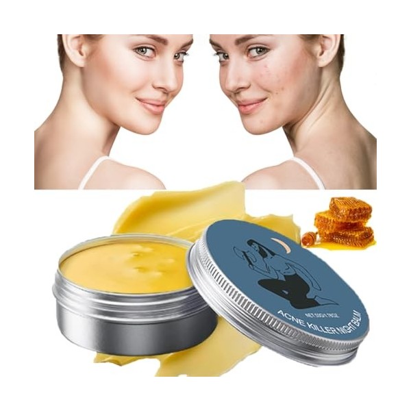 Norse Organics Baume anti-acné, baume anti-acné Norse Organics, tueur dacné et de rougeurs, crème éclaircissante pour homme