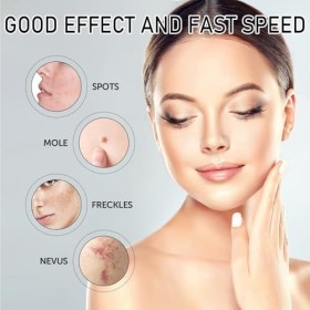 Acne Pimple Patch,Bandages hydrocolloïdes pour le Traitement des Boutons,Patch Bouton Anti Acné,Skin Tag Remover Patch,Transl