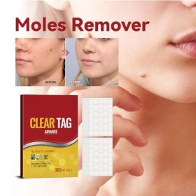 Acne Pimple Master Patch,Acne Pimple Patch,Patch Anti Acrochordons,Patches Contre l’acné,Skin Tag Remover,Wart Remover,Patch 