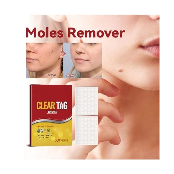 Acne Pimple Master Patch,Acne Pimple Patch,Patch Anti Acrochordons,Patches Contre l’acné,Skin Tag Remover,Wart Remover,Patch 