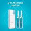 Aquavis Gel anti-acne - Formule innovante pour lutter contre lacné, réduire les imperfections et les cicatrices, pour une pe