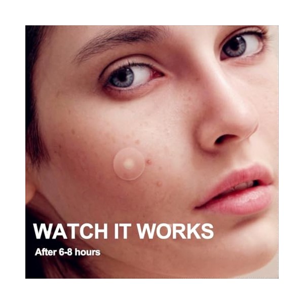 ZKGYUS 240 patch bouton,Hydrocolloïde autocollant dacné absorber le pus peau artificielle autocollant dacné peut maquillage