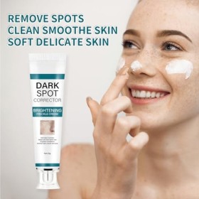 Crème de beauté anti-taches de rousseur, correcteur de taches de rousseur, correcteur de taches sombres, anti-taches brunes p