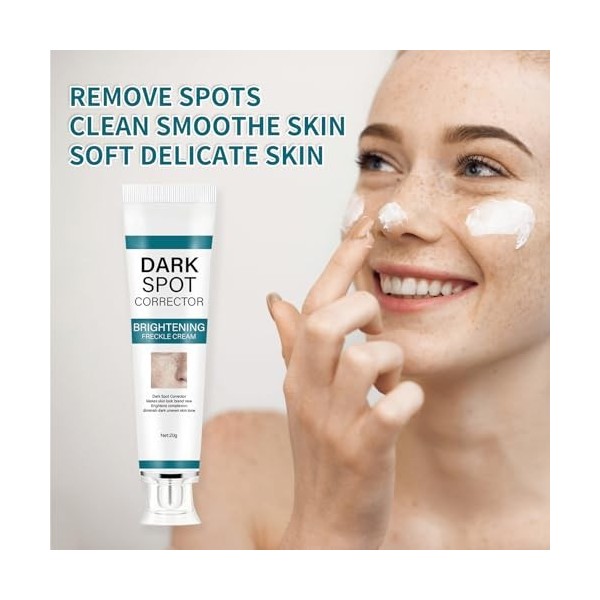 Crème de beauté anti-taches de rousseur, correcteur de taches de rousseur, correcteur de taches sombres, anti-taches brunes p