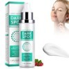 Dark Spot Corrector Cream Crème pour le visage et le visage, Dark Spot Correcting Cream,Dark Spot Remover Pour Le Visage, Le 
