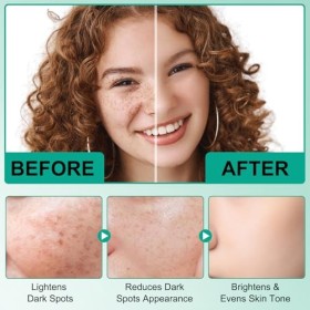 Dark Spot Corrector Cream Crème pour le visage et le visage, Dark Spot Correcting Cream,Dark Spot Remover Pour Le Visage, Le 