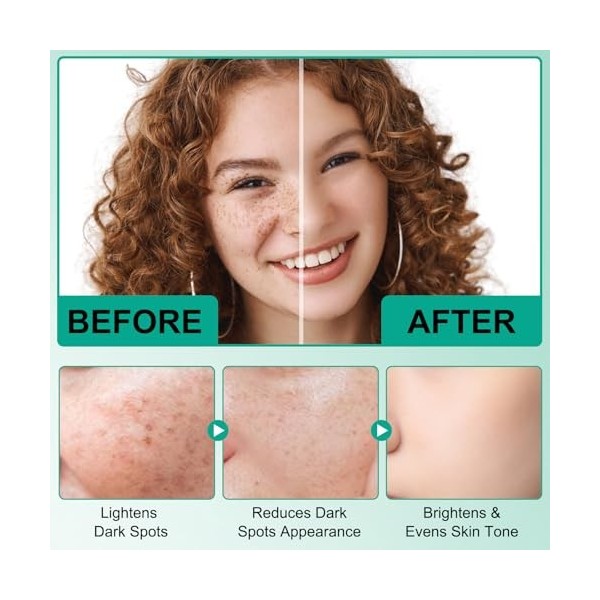 Dark Spot Corrector Cream Crème pour le visage et le visage, Dark Spot Correcting Cream,Dark Spot Remover Pour Le Visage, Le 