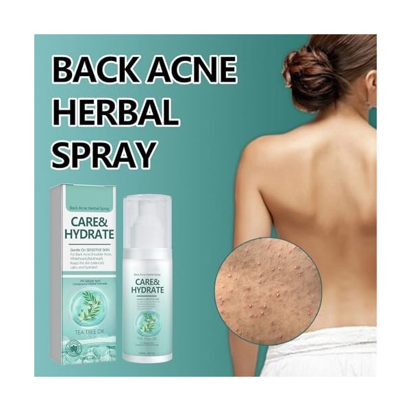 2 PCS Spray de Traitement de LAcné du Dos, Spray Nettoyant pour lacné du Dos, Nettoyage en Profondeur de lacné du Corps, N