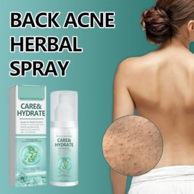 2 PCS Spray de Traitement de LAcné du Dos, Spray Nettoyant pour lacné du Dos, Nettoyage en Profondeur de lacné du Corps, N