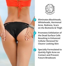 Traitement anti-acné extrême pour le visage et les fesses et les cuisses - Nettoie les boutons dacné et les poils incarnés p