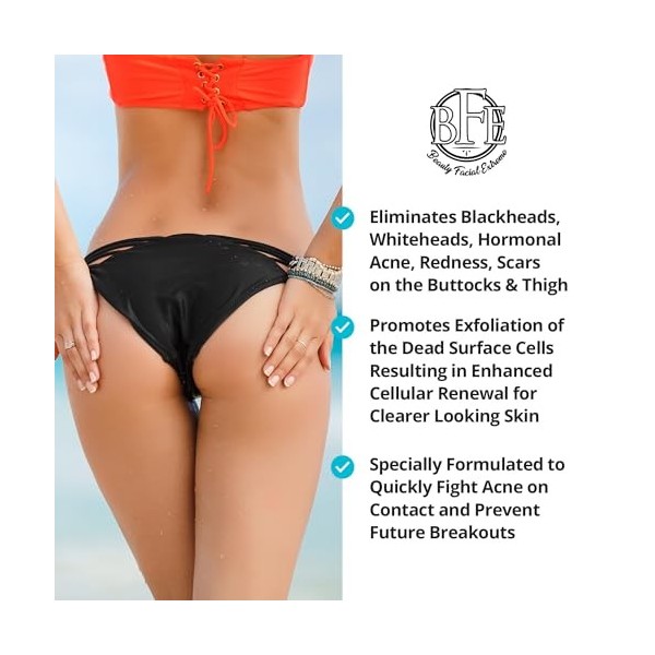 Traitement anti-acné extrême pour le visage et les fesses et les cuisses - Nettoie les boutons dacné et les poils incarnés p