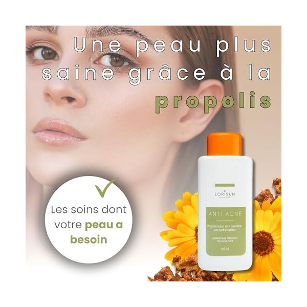 Lorisun Lotion Anti Acné avec Propolis et Calendula | Traitement de lAcné Sévère | Anti Acné Visage | Nettoie et Purifie la 