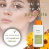 Lorisun Lotion Anti Acné avec Propolis et Calendula | Traitement de lAcné Sévère | Anti Acné Visage | Nettoie et Purifie la 