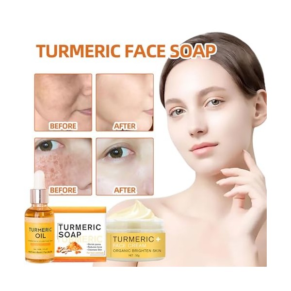 Turmeric Crème Au Curcuma + Huile Au Curcuma + Savon Au Curcuma,Kit De Soin De La Peau Au Curcuma 3 En 1,Trio De Soins Au Cur