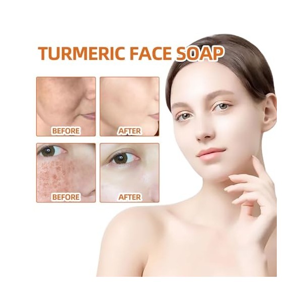2PC Savon au Curcuma,Barre de Savon pour le Visage et le Corps,Anti Taches Savon Curcuma Kojic-Acid Soap,Savon pour les Tache