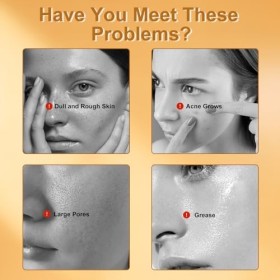 Lot de 2 Savon à Lacide Kojique Savon Curcuma, Turmeric Kojic Acid Soap Naturel pour Taches Sombres, Doux pour lHydratation