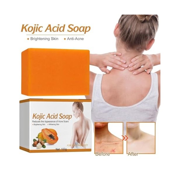 Grgowe 2PC Savon À LAcide Kojique,Savon Curcuma,Savon à lAcide Kojique Pour lHyperpigmentation,Savon à LAcide Kojique Pou