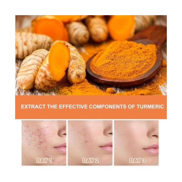 Savon Au Curcuma,Turmeric Soap,Savon Curcuma Visage,Savon à Lacide Kojique,Savon Exfoliant Au Curcuma,Savon de Bain pour le 