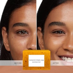 Savon à Lacide Kojique, au Curcuma, Savon Exfoliant Au Curcuma, Barre De Savon Pour Le Visage Le Corps Le Nettoyage Du Savon