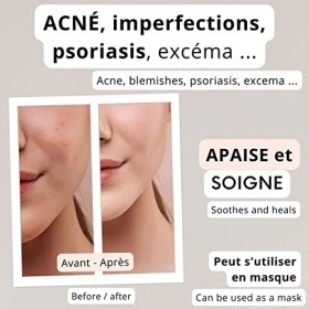 IZOË, Savon Lait de Chevre Solide BIO, Coffret 4 x 100g, pour un Teint de Pin Up, Peau Visage + Corps, Bébé, PH Neutre, Surgr
