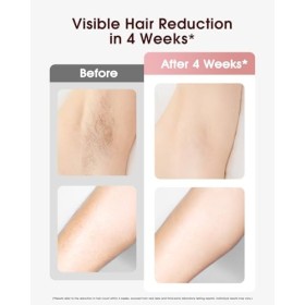 LYSMOSKI Laser Hair Removal, IPL Hair Removal with for Painless & Long-Lasting Result, Safe At-Home Hair Remover Device for A