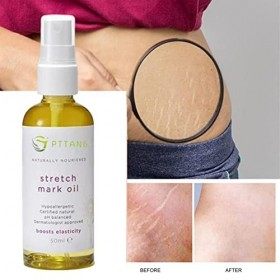 Huile de Massage - 50 ml/100 ml dhuile de massage pour les vergetures - Soulevez labsorption transdermique hydratante raffe