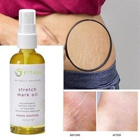 Huile de Massage - 50 ml/100 ml dhuile corporelle pour les vergetures | Améliorer lélasticité de la peau Hydratant corporel