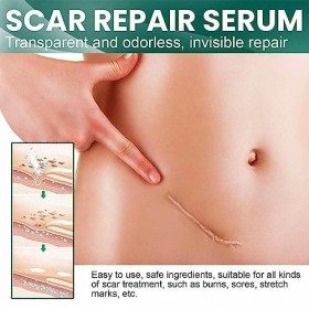 Rianpesn Huile de Cicatrice - Réparation de Cicatrice Liquide raffermissant pour Les vergetures,30 ML dhuile de réparation d