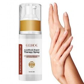 Rianpesn Nigricans Thérapies Spary | Huile Correctrice Taches Noires 30 ML,Acanthosis Nigricans Traitements pour Le Genou, Le
