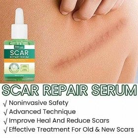 Gel délimination des cicatrices | Huile pour la réparation des vergetures et lélimination des cicatrices,30 ml dhuile de r