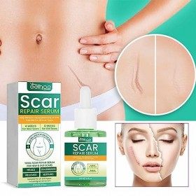 Cyhamse Huile Anti-vergetures | Réparation de Cicatrice Liquide raffermissant pour Les vergetures,30 ML de dissolvant de Cica