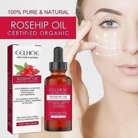 Huile de rose musquée biologique | Huile visage bio à la rose musquée pressée à froid,30 ml dhuile faciale hydratante pour l
