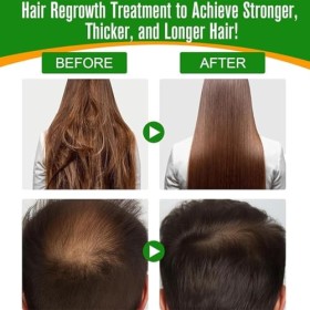 Baorder Huile de Batana pour la croissance des cheveux,huile capillaire biologique Batana 100% naturelle,améliore les cheveux