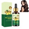 Hppsctink Huile de Croissance au Gingembre, 30ml Sérum Densifiant au Gingembre, Huile Capillaire au Gingembre, Réparer les Ch