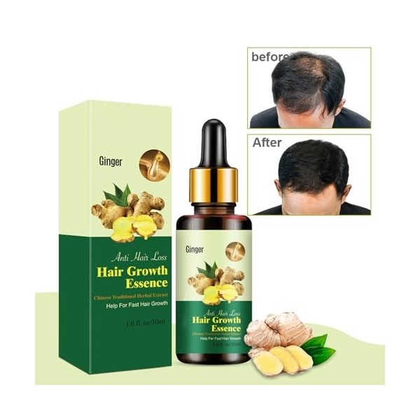 Hppsctink Huile de Croissance au Gingembre, 30ml Sérum Densifiant au Gingembre, Huile Capillaire au Gingembre, Réparer les Ch